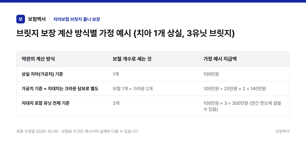 브릿지 보장 계산 방식별 가정 예시 (치아 1개 상실, 3유닛 브릿지) — 치아보험 브릿지 틀니 보장 비교표